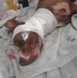 Fotos de Atingida por tiros durante execução em Sarandi, cachorra da raça pit bull morre após cirurgia