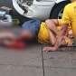 Fotos de Feirante é atropelado por motorista embriagado e tem perna amputada em Sarandi