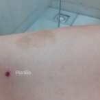 Fotos de Homem atira quatro vezes contra ex-namorada grávida em Maringá