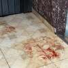Fotos de Homem tenta matar ex-mulher com golpes de faca