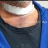 Fotos de Motociclista tem pescoço cortado por linha chilena em Maringá