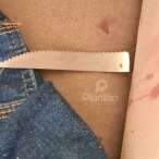 Fotos de Mulher é esfaqueada ao retornar para casa e encontrar marido com uma adolescente de 17 anos em Sarandi