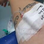 Carro invade preferencial, deixa motociclista com ferimentos graves em Maringá; vídeo Foto 1 Fotos de Carro invade preferencial, deixa motociclista com ferimentos graves em Maringá; vídeo