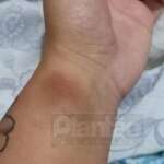 Carro invade preferencial, deixa motociclista com ferimentos graves em Maringá; vídeo Foto 8 Fotos de Carro invade preferencial, deixa motociclista com ferimentos graves em Maringá; vídeo