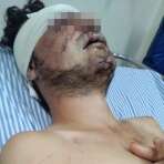 Fotos de Polícia procura por suspeito de espancar e roubar estudante durante assalto, em Maringá