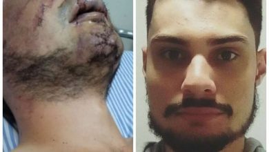 Fotos de Estudante de letras é brutalmente espancado durante roubo em Maringá