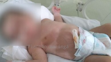 Fotos de Família faz apelo para salvar bebê que nasceu com tumor no estômago em Sarandi
