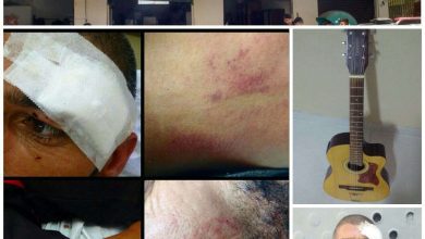 Fotos de Homem furta comércio no Jardim Independência e foi agredido por populares e em seguida é preso pela equipe da Guarda Municipal de Sarandi