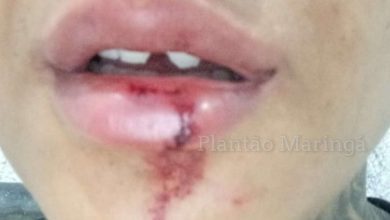 Fotos de Não me arrependo, pois cansei de apanhar, diz mulher que esfaqueou o marido