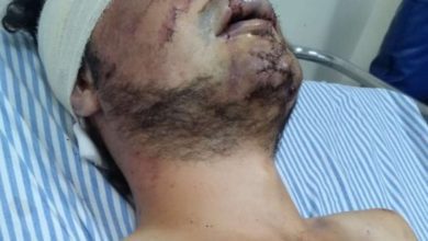 Fotos de Polícia encontra celular do estudante de letras brutalmente agredido durante roubo em Maringá; duas pessoas foram presas