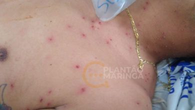 Fotos de Trabalhador leva mais de 300 picadas de abelhas em Sarandi