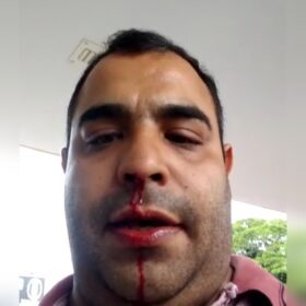 Fotos de Homem diz ter sido agredido por primeira dama de Sarandi após ele cobrar prefeito por melhorias na saúde