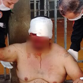 Fotos de Homem é brutalmente agredido com pedradas na cabeça em Maringá