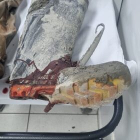 Fotos de Trabalhador é resgatado após ficar com pé preso em caminhão betoneira em Maringá 