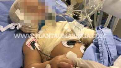 Fotos de Criança sofre queimaduras graves com óleo quente em Maringá, e é transferida para hospital especializado em queimados