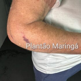 Fotos de Idosa de 72 anos é covardemente agredida durante roubo a residência em Maringá 