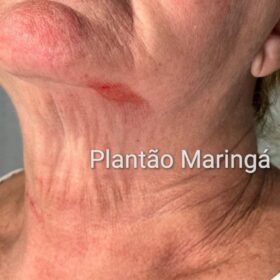 Fotos de Idosa de 72 anos é covardemente agredida durante roubo a residência em Maringá 