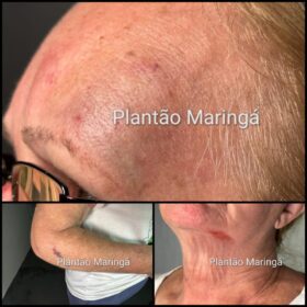 Idosa de 72 anos é covardemente agredida durante roubo a residência em Maringá Foto 1 Fotos de Idosa de 72 anos é covardemente agredida durante roubo a residência em Maringá