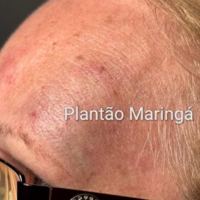 Fotos de Idosa de 72 anos é covardemente agredida durante roubo a residência em Maringá 