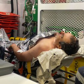 Fotos de Homem é encontrado por populares caído com facada nas costas 