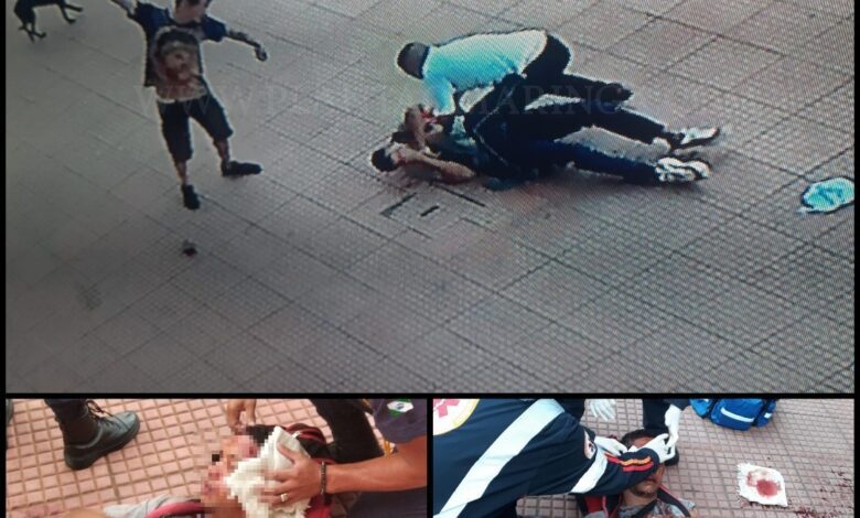 Fotos de Homem é agredido com tijoladas após brigas entre guardadores de carros em Maringá 
