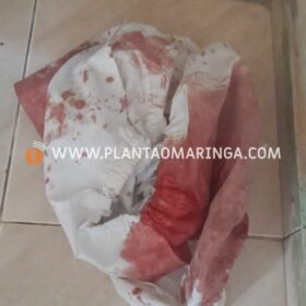 Fotos de Homem sofre duas tentativas de homicídio em um único dia em Maringá