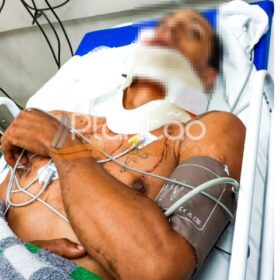 Jovem de 27 anos é baleado no rosto e nas nádegas em Maringá Foto 1 Fotos de Jovem de 27 anos é baleado no rosto e nas nádegas em Maringá