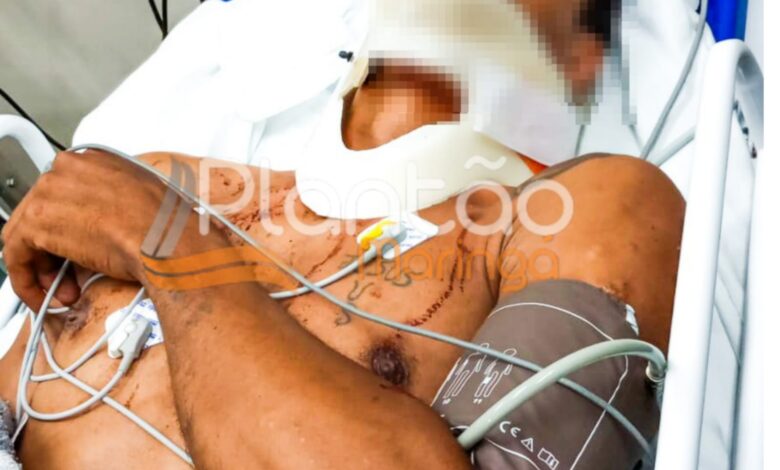 Fotos de Jovem de 27 anos é baleado no rosto e nas nádegas em Maringá