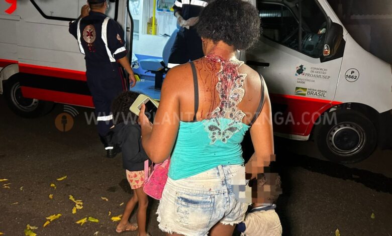 Fotos de Mulher é agredida por ex-companheiro com golpe de facão na cabeça em Maringá