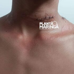 Fotos de Mulher e criança ficaram feridas com linha de pipa em Sarandi