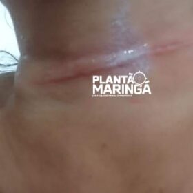 Fotos de Mulher e criança ficaram feridas com linha de pipa em Sarandi