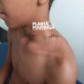 Mulher e criança ficaram feridas com linha de pipa em Sarandi Foto 1 Fotos de Mulher e criança ficaram feridas com linha de pipa em Sarandi
