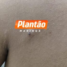 Fotos de Jovem é baleado no peito enquanto andava de moto elétrica em Sarandi