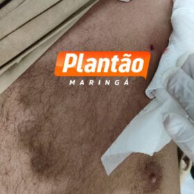 Fotos de Jovem é baleado no peito enquanto andava de moto elétrica em Sarandi