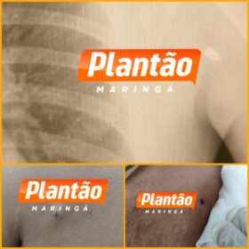 Jovem é baleado no peito enquanto andava de moto elétrica em Sarandi Foto 1 Fotos de Jovem é baleado no peito enquanto andava de moto elétrica em Sarandi