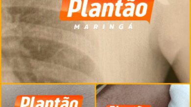 Fotos de Jovem é baleado no peito enquanto andava de moto elétrica em Sarandi