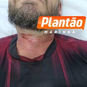 Fotos de Motociclista tem pescoço cortado por linha chilena em Sarandi