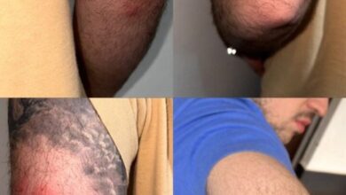 Fotos de Percevejos atacam passageiros em ônibus leito-cama em linhas de Maringá