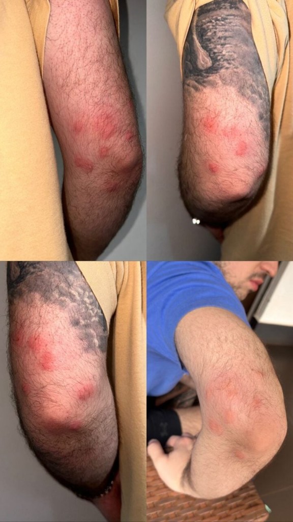 Fotos de Percevejos atacam passageiros em ônibus leito-cama em linhas de Maringá