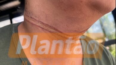 Fotos de Câmera registra jovem que teve o pescoço enroscado em fiação solta em Maringá