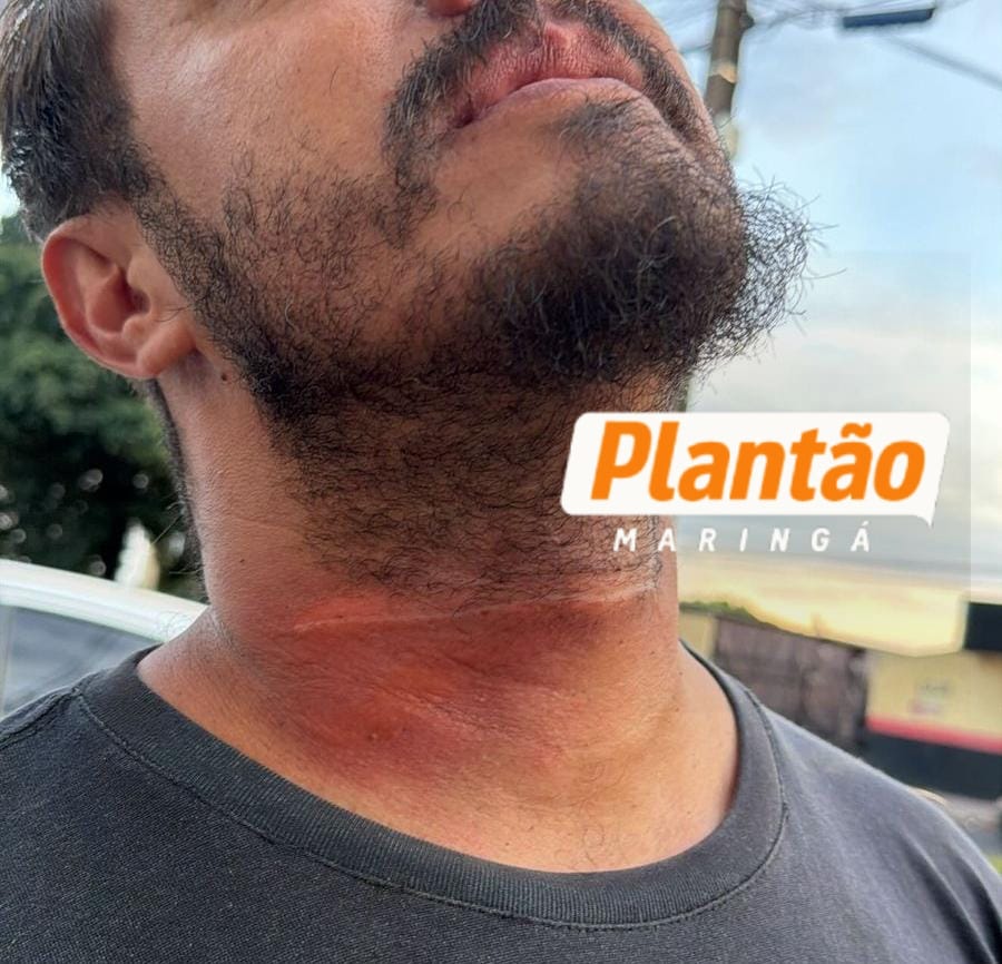 Fotos de Câmera registra queda de motociclista após fio atingir pescoço em avenida de Maringá