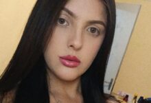 Fotos de ‘Deus me deu uma segunda chance’, relata jovem de Maringá que sofreu queimaduras em 40% do corpo em acidente de trabalho