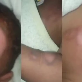 Fotos de Bebê que sofreu queimaduras durante banho em creche de Sarandi deixa hospital após seis dias internado