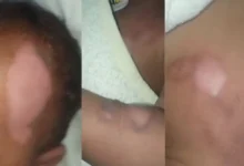 Fotos de Mãe atualiza estado de saúde de bebê de 9 meses que sofreu queimaduras graves em creche e segue internado no HU de Maringá