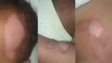 Fotos de Mãe atualiza estado de saúde de bebê de 9 meses que sofreu queimaduras graves em creche e segue internado no HU de Maringá