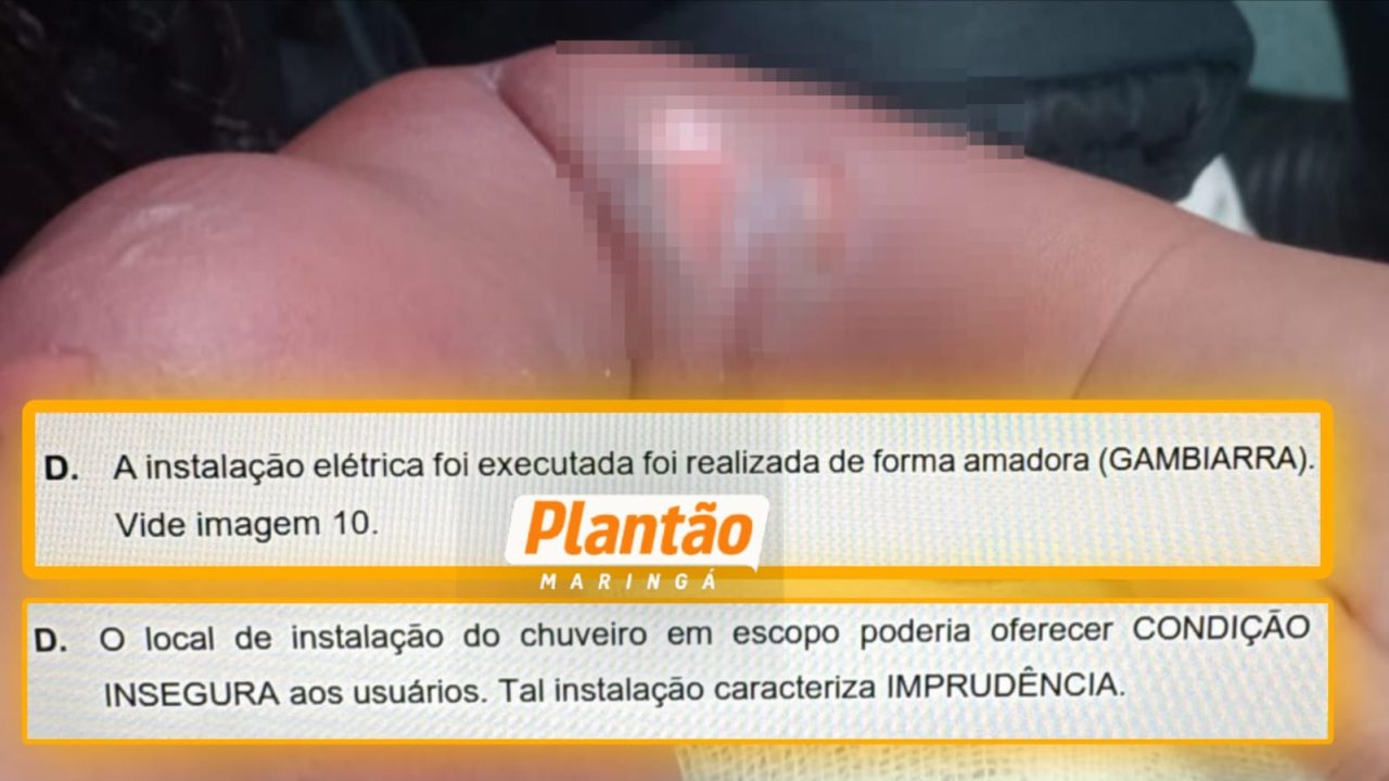 laudo-aponta-ligacao-eletrica-irregular-em-chuveiro-de-cmei-onde-bebe-sofreu-queimaduras-em-sarandi