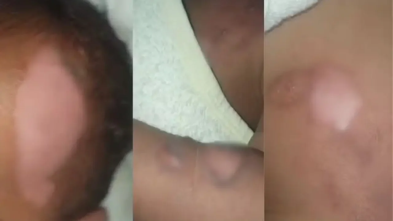 mae-atualiza-estado-de-saude-de-bebe-de-9-meses-que-sofreu-queimaduras-graves-em-creche-e-segue-internado-no-hu-de-maringa